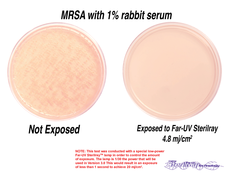 MRSA with serum petri dishes