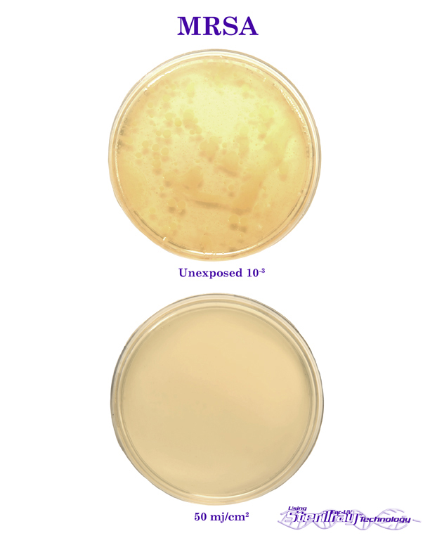 MRSA petri dishes